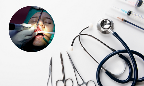 Gum Surgery in Udumalpet